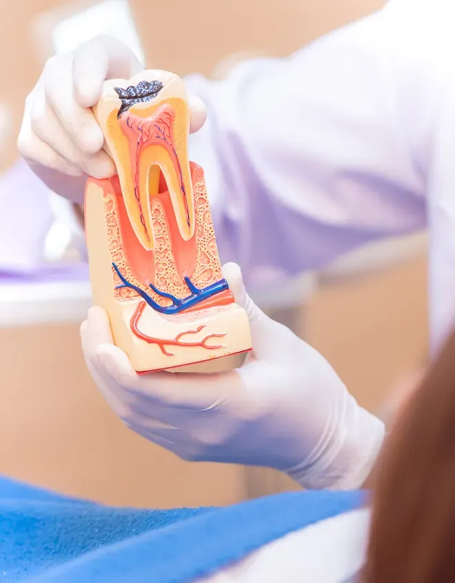 Why You Shouldn’t Delay a Root Canal The Risks of Waiting Too Long