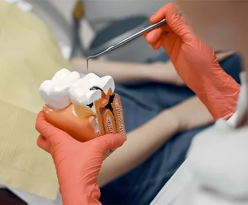 What Happens During a Root Canal? A Step-by-Step Look at the Procedure  